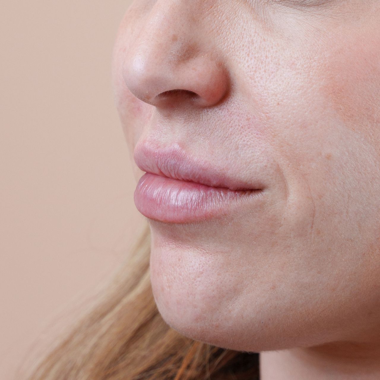 Lippen Ergebnis von Patientin nach der Behandlung