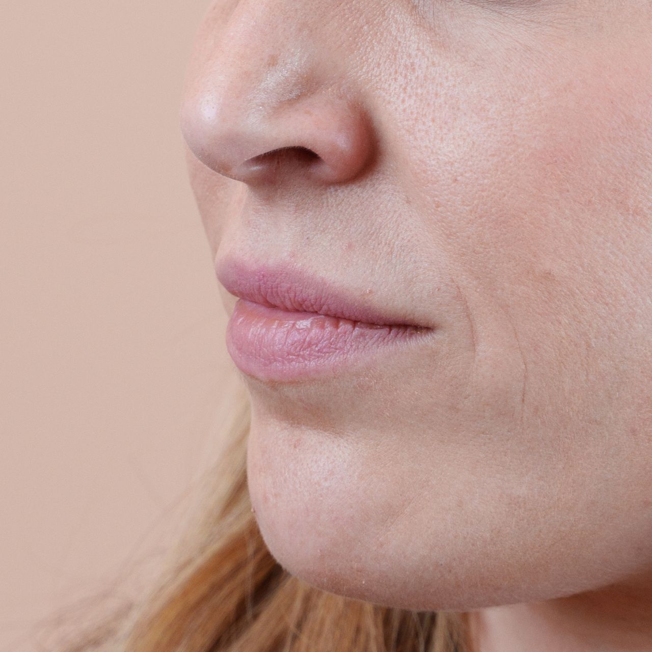 Lippen von einer Patientin vor der Behandlung