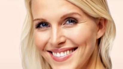 glowtox nasolabialfalten loop blonde Frau