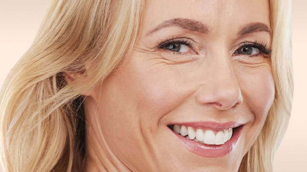 Bild eines Modells Krähenfüße Behandlung glowtox
