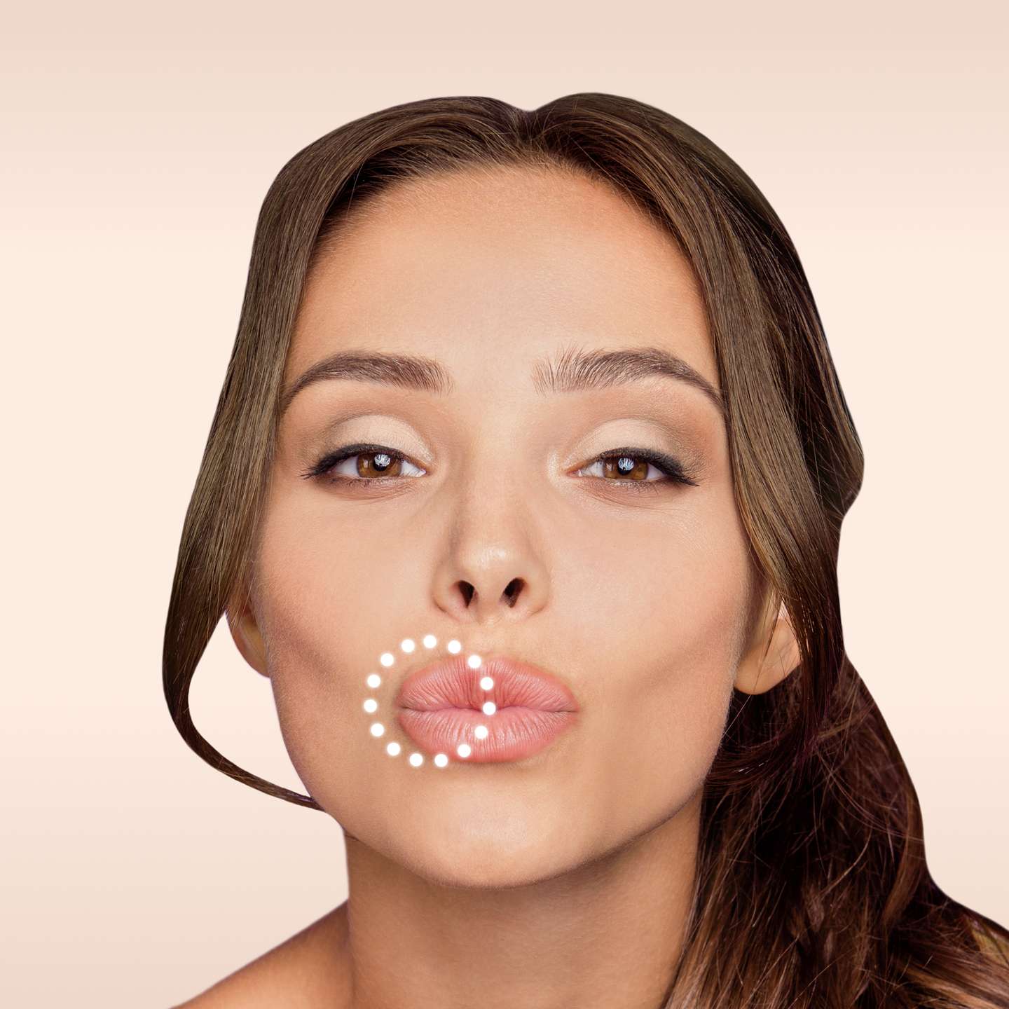 Bild eines Modells Lippenaufbau Behandlung glowtox